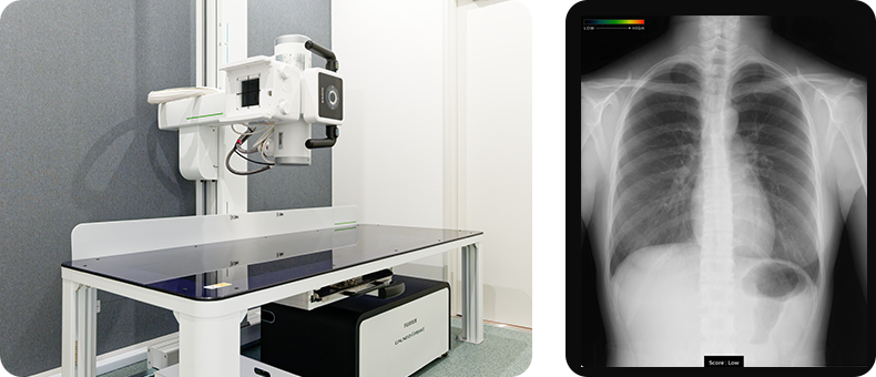 レントゲン検査